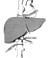 Figure 3 Figure 3