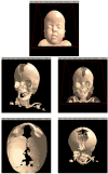 Figure 5 Figure 5